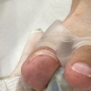 레푸스인하대역점 내성발톱 무좀발톱 발각질 문제성발 이미지