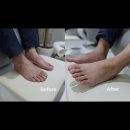 대지약국 | 평택 안중 [비앤브이] 무좀 케어 후기 신박한 부모님 효도 선물