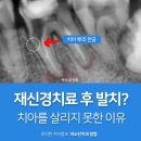 미소진치과의원 | 부산충치치료 재신경치료 시 발생할 수 있는 의료사고