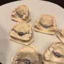 최종석치과의원 | 교정을 했는데 숨시기가 좋아졌다고요? "최신교정장치 MARPE"