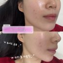 3뷰티 | 마산피부관리 수앤유뷰티 3번째 방문 후기