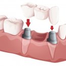 서울앤치과 이미지