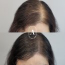 일산두피&눈썹단미토탈뷰티
