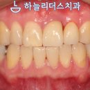 하늘치과기공소 이미지