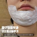 압구정 | 압구정피부과 울쎄라 리프팅 시술 내돈내산 후기