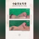 로웰성형외과의원 이미지
