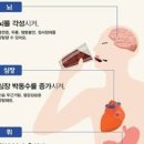 커피 심장 두근거림 카페인 과다섭취 부작용 이미지
