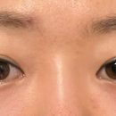 뷰티앤영의원 이미지