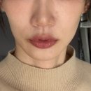 한스벨뷰티 | 엄청난 서칭 후 찾아 간 천호역피부과 티타늄리프팅