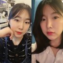 오편한 의원 | 썸블리의원에서 입술필러 몰딩 진짜 잘해요 찐후기(일주일 후기)