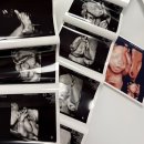 정이비인후과 | 23주 임산부 감기 걸린 후기/ 감기약가능? 산부인과, 이비인후과 항생제처방