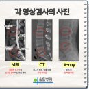 자생한방병원 | 울산 자생한방병원 통원치료/MRI 후기(상대과실 100% 후방추돌 사고 합의금)