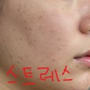(주)플루엔 | 멜라논크림 동아제약 걱정많은 병행 찐후기