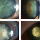 안경사랑안경콘택트 이미지