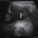 청아여성의원 이미지