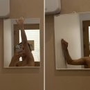 다운에이징자연성형연구소 | 지방흡입 바본관리 고민이라면? 팔뚝 람스 성공 후 더편안스파에서 관리받은 후기
