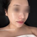 서해상동주유소 | 부천피부관리 물광피부 만들어주는 압출맛집 브이메디스파 부천점 내돈내산후기