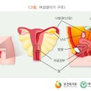 난소암이란? 이미지