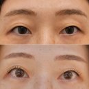 위례 속눈썹 아우룸로즈 후기 / 무쌍 눈매에 맞춘 펌, 주기