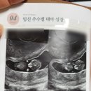 [임신일기] 9주차 초음파, 메디엘라산부인과, 디어원 산후조리원 프로그램, 마사지, 가격, 상담후기