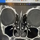 서울삼성이비인후과의원 이미지