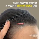 선헤어라인 이미지