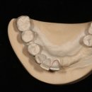 위드치과기공소 이미지