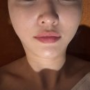 라스트뷰티 | 청담피부관리 강남에스테틱 뷰티블르바드 겨울철 수분관리 후기