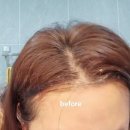 맑은샘생활건강 주식회사 | [모메딕샴푸]_ 한달 사용 후기_탈모예방, 두피케어에 만족했던 맑은샘생활건강