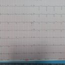 심전도 봐주세요 이미지