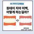 지에스25 김해우가주치과점 | [김해 우가주치과병원] 원데이치아미백, 어떻게 하는 걸까?