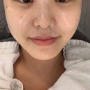 [올가드림 뷰티 증산점] 모공, 여드름 피부 모공 디톡스 강추 후기