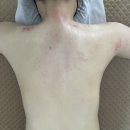 퓨리떼스킨케어 | 김해 율하 지심뷰티 / 테라노바 기계로 상체 통증 관리 받은 리얼 후기‼️‼️