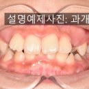 웃는E치과교정과치과의원 네이버블로그