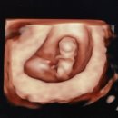 집밥 쿡선생 | [임신일기] 09. 임신 초기 기록 (6주 차~12주 차) (초음파, 니프티 검사, 1차 기형아 검사)