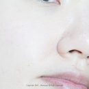 스마일클리닝 이미지