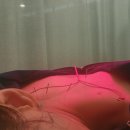 라운드숄더 굽은등 거북목 교정으로 바른자세와 통증 개선 듀오커브 견인기