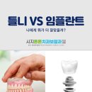 시지에프엠치과병원 | 수성구치과추천 틀니와 임플란트 중 뭐가 나을까?