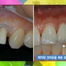 크라운치과기공소 이미지