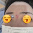 영광한의원 | 부산흉터제거 흉터제거한의원 오래된흉터 30년된흉터치료 후기