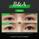 아이컨텍성형외과의원 이미지