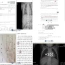 🔻사천에서 강제분리된 후 갈비뼈 골절이 발견된 하온이 영아 사건을 원가정인권보호연대 유투브에 올렸는데, 전국통합뉴스 김경옥 기자께서 이미지