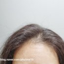 숙이네 뷰티 헤어 | 려 루트젠 여성탈모 뿌리볼륨 샴푸 추천템