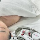 오드리이모션 | 대전괴정동 mts관리 오드리이모션 (첫mts 효과 및 부작용, 주의사항)