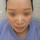 세라빌딩 | 의정부피부샵 오이유스킨에서 스킨세라링 받고 온 후기!