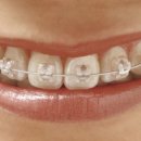 웅진치과의원 이미지