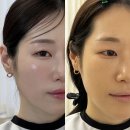 웨딩 메이크업 종류 천안 이날뷰티스튜디오 하영 대표원장 가격 솔직후기