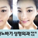 역삼바노바기성형외과 네이버블로그