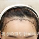 선헤어라인 - 종로구 | 선헤어라인