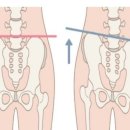 관악제일약국 | 봉천동PT / 에스짐관악봉천점 / 김수지트레이너_PT후기 / 엉덩이부터 다리까지 통증 있을 때